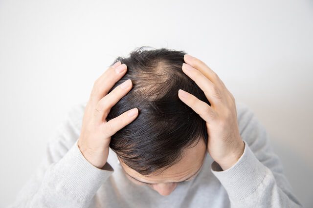 朝シャワーは禿げる？健康的な髪の毛を保つおすすめの方法