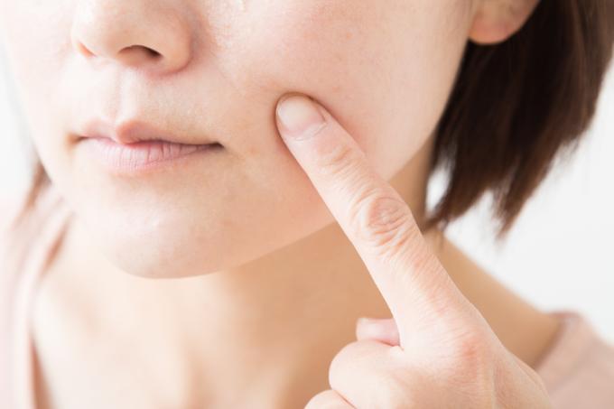 垢がよく出る人の特徴と原因